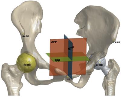 Postoperative hip center position is associated with gait symmetry in range of axial rotation in dysplasia patients after THA